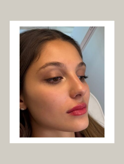 Micropigmentation (2)
